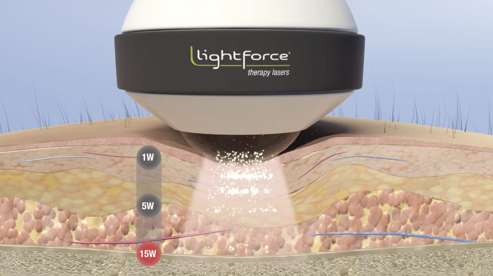 Laser therapy